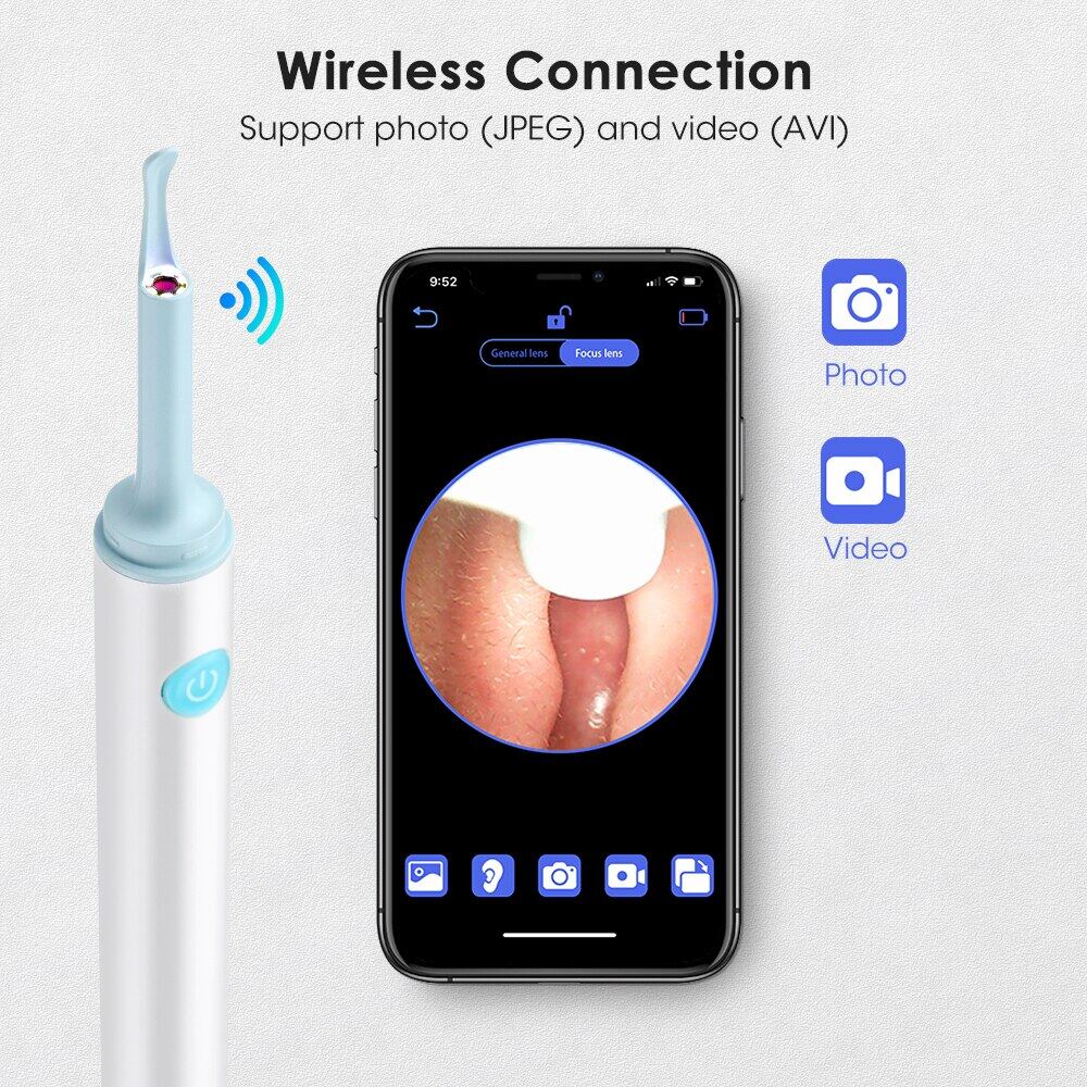 3.9mm WiFi Visual Ear Spoon 5.0MP Otoscope Endoscope Camera